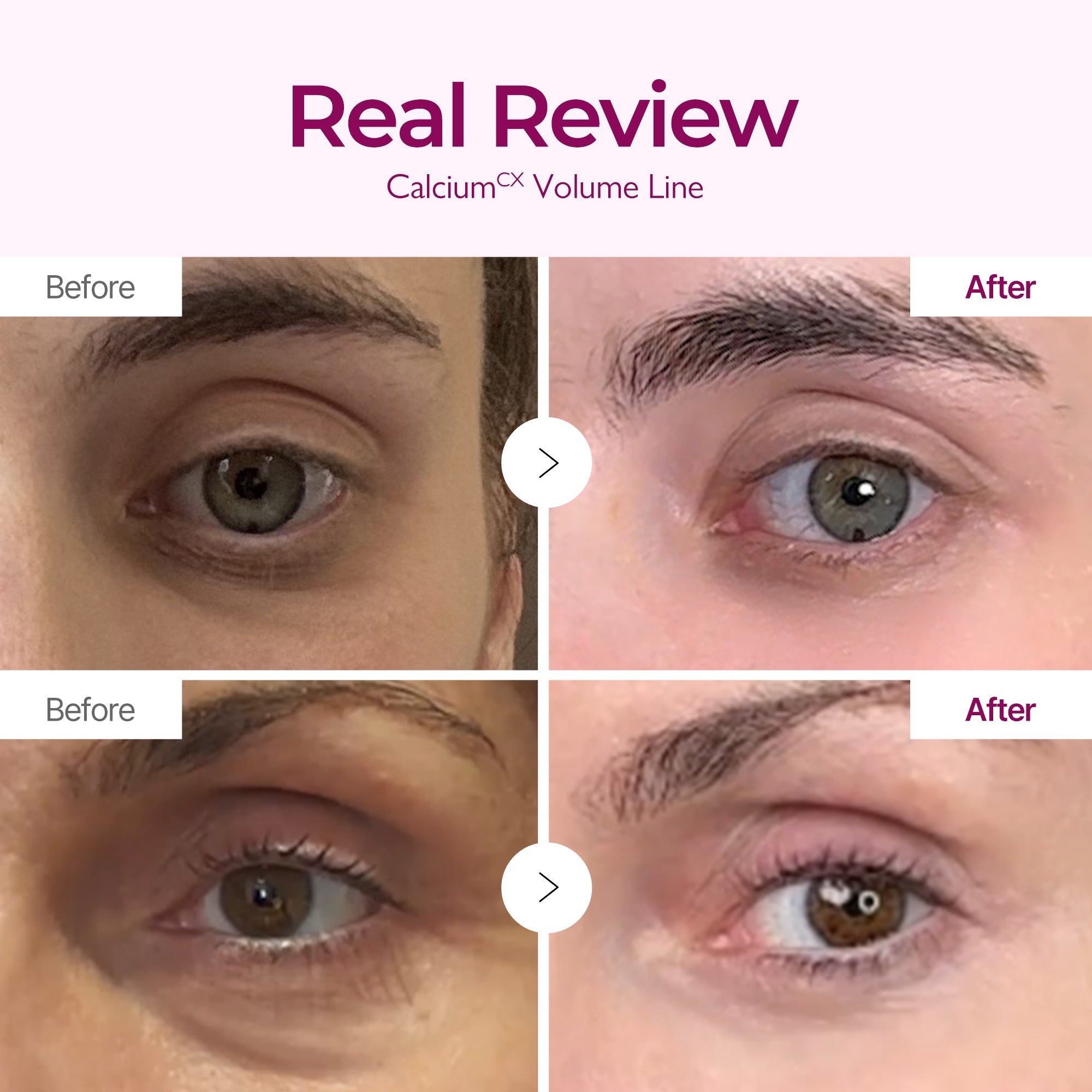 Calcium Intense Cream - image 3