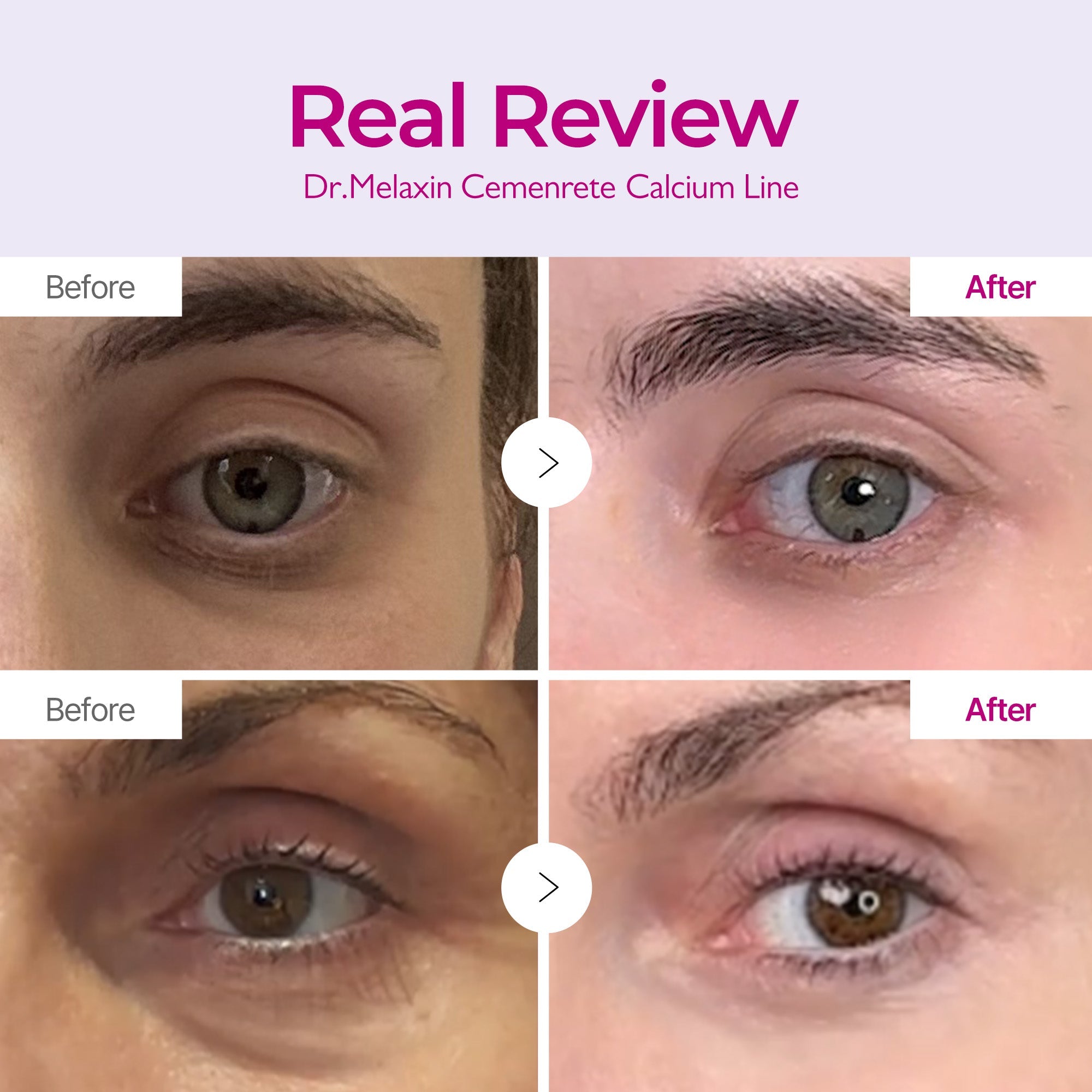 Calcium Eyecare Routine Set - image 3