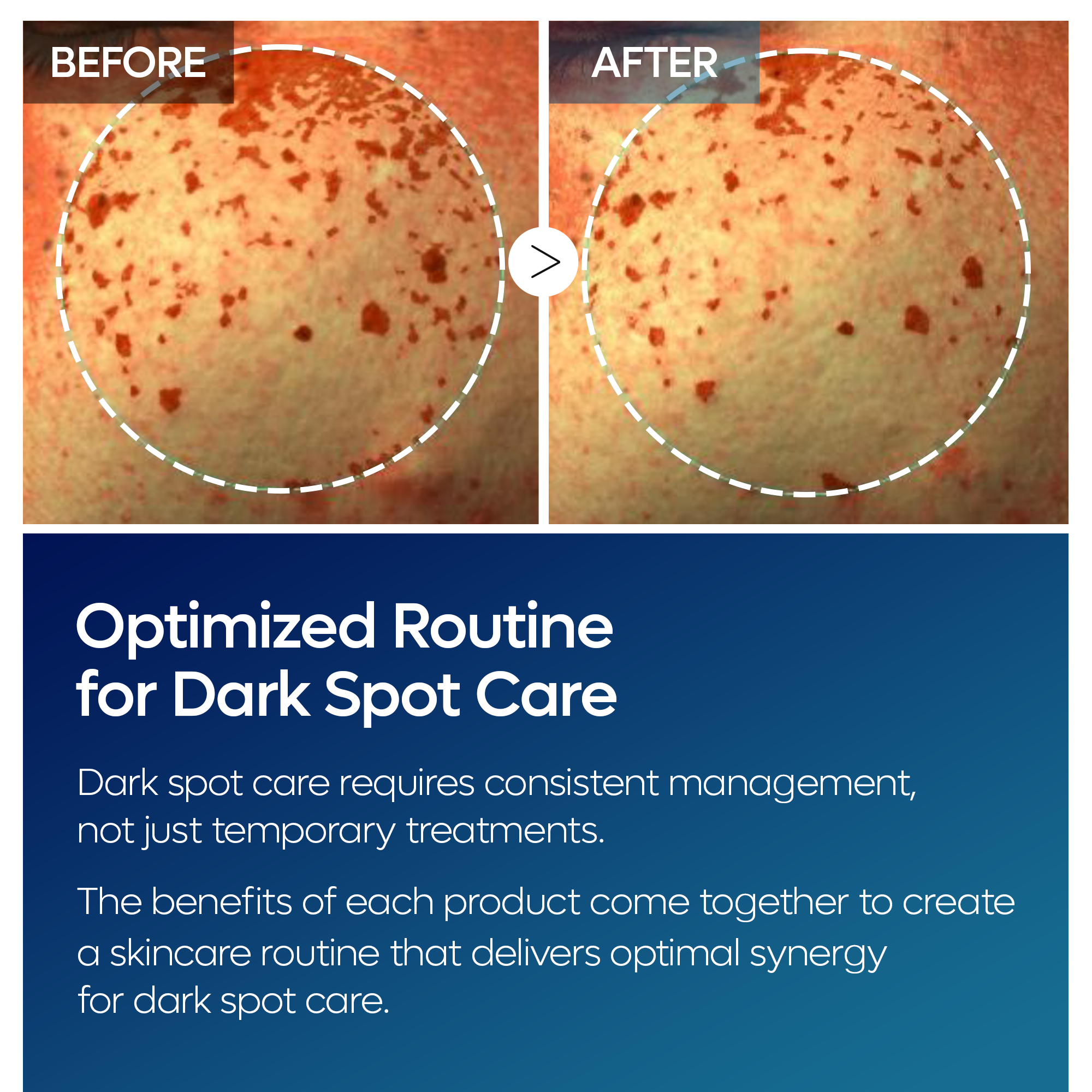 TX Tranexamic Acid Dark Spot Care Line - image 9
