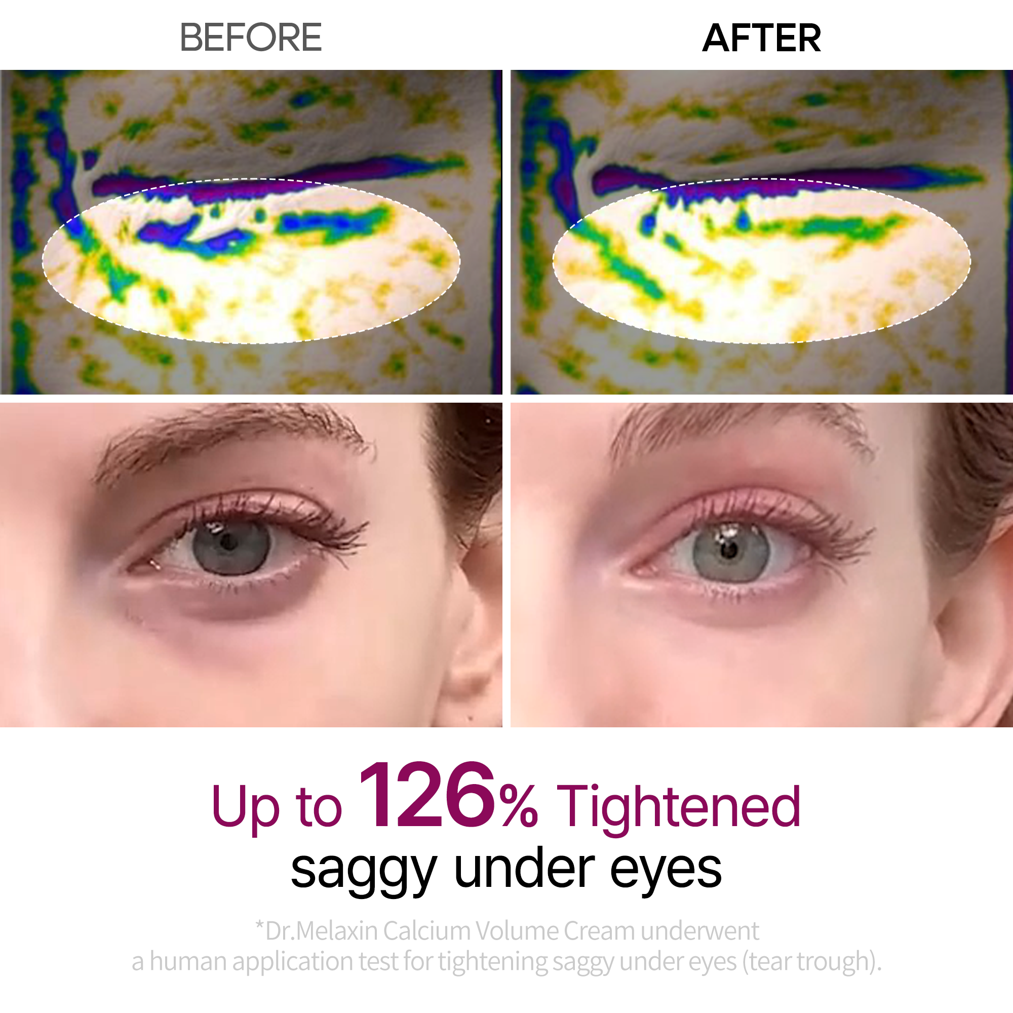 Calcium Eye care Line - image 3