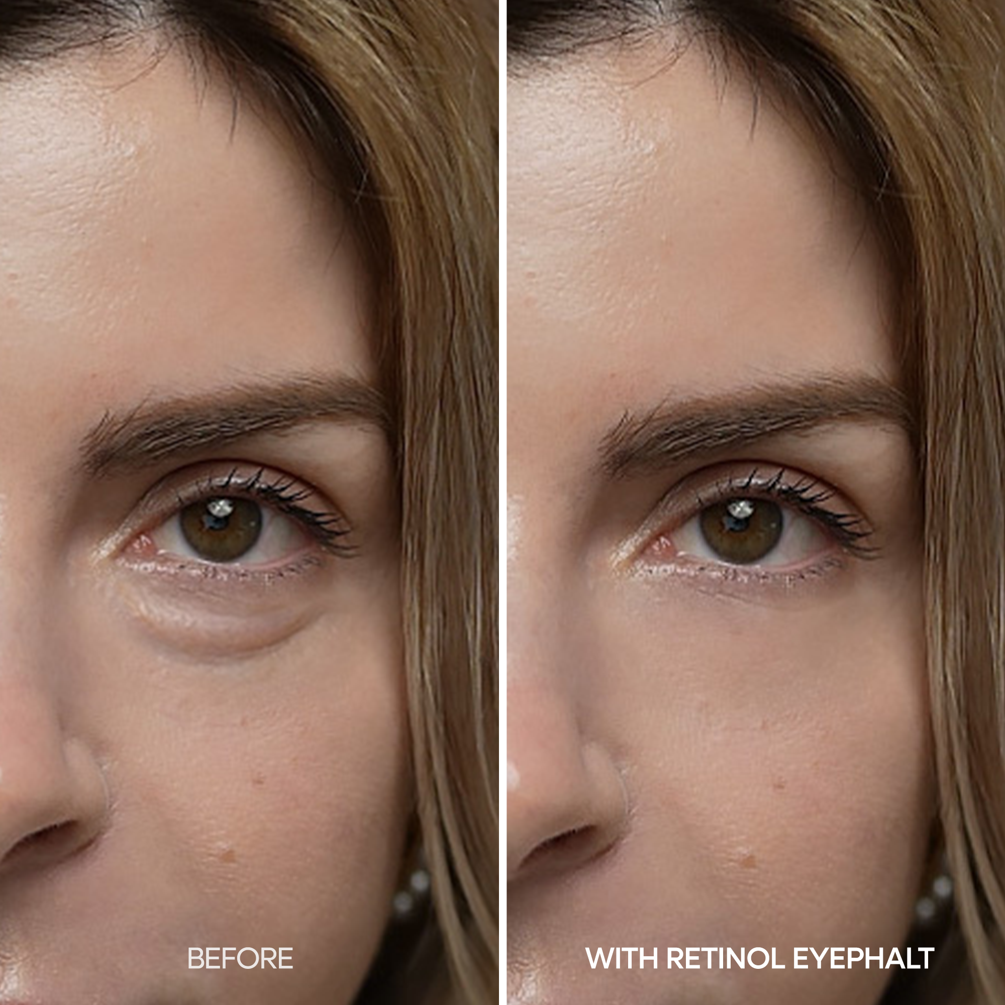 [Day&Night Care] Eyephalt Eyebag Lifting Line - image 6