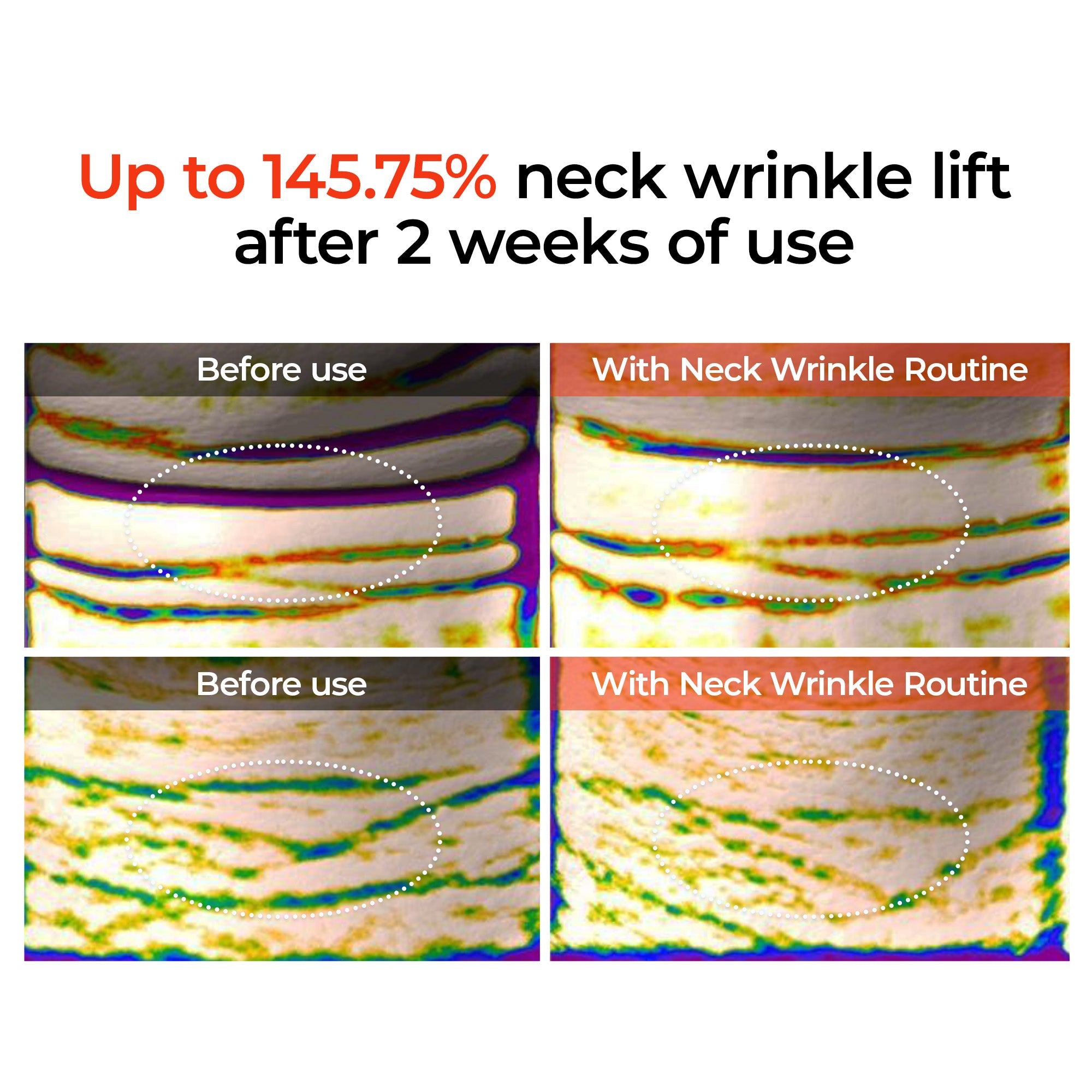 Calcium Boost Neck & Eye Set - image 9