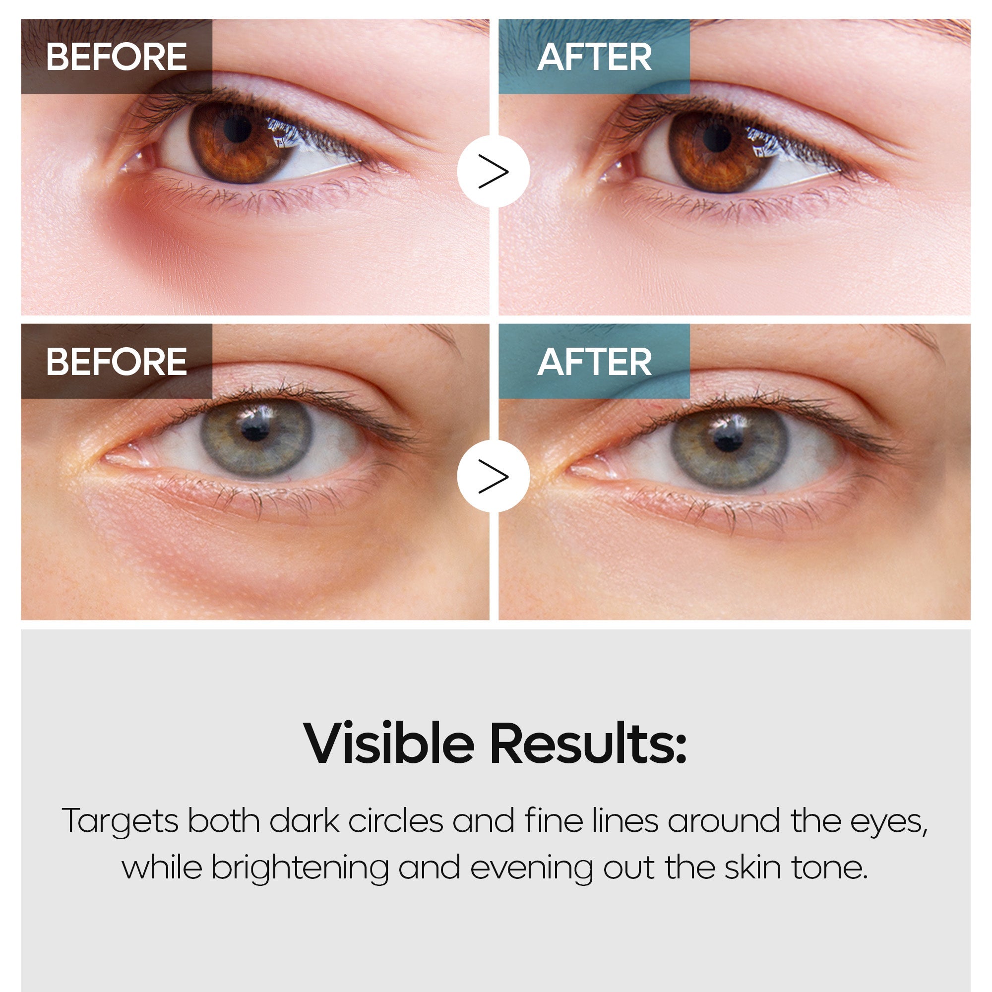 TX Retinalsome Double Effect Eyecream - image 6