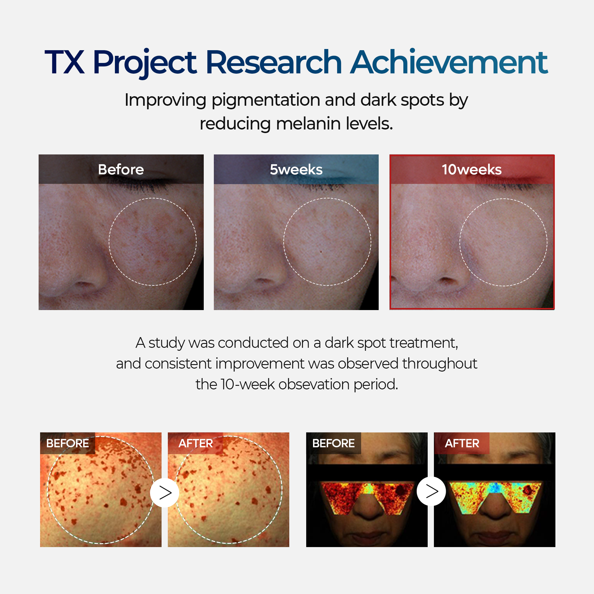 TX Tranexamic Acid Dark Spot Care Line - image 6