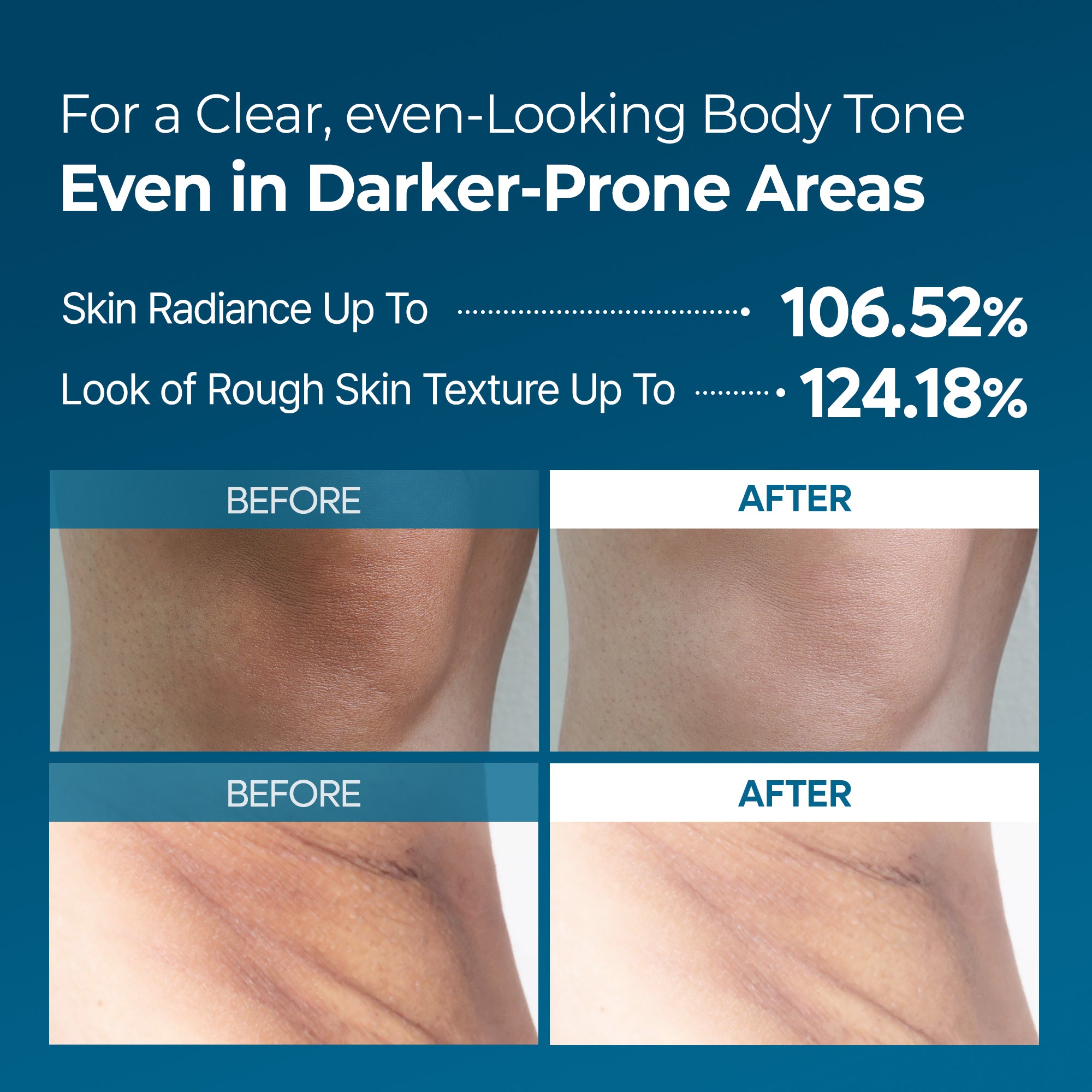 Peel Shot Exfoliating TX Spray - image 7